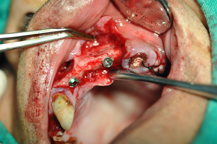 %_tempFileNameImplant%2080b4%
