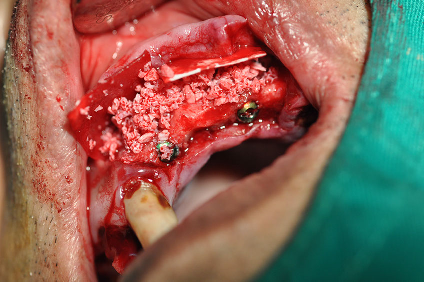 %_tempFileNameImplant%2080b5%
