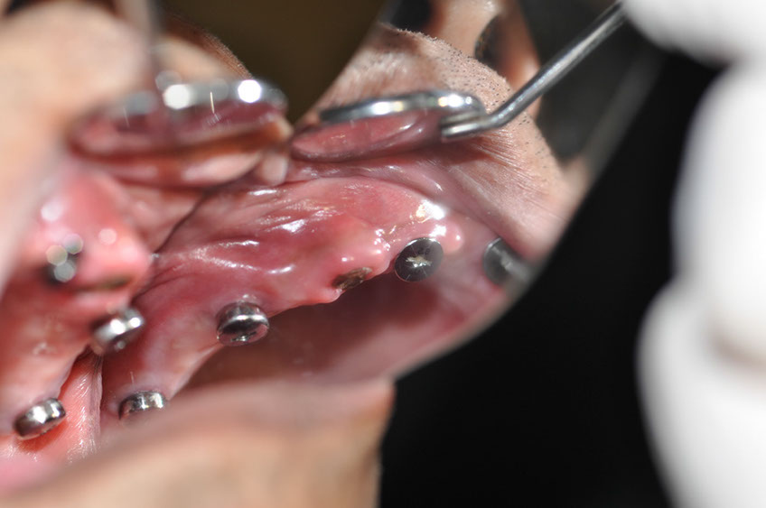%_tempFileNameImplant%2080c5%20%