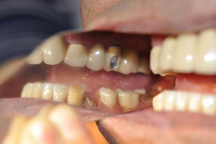 %_tempFileNameImplant%2080c7%