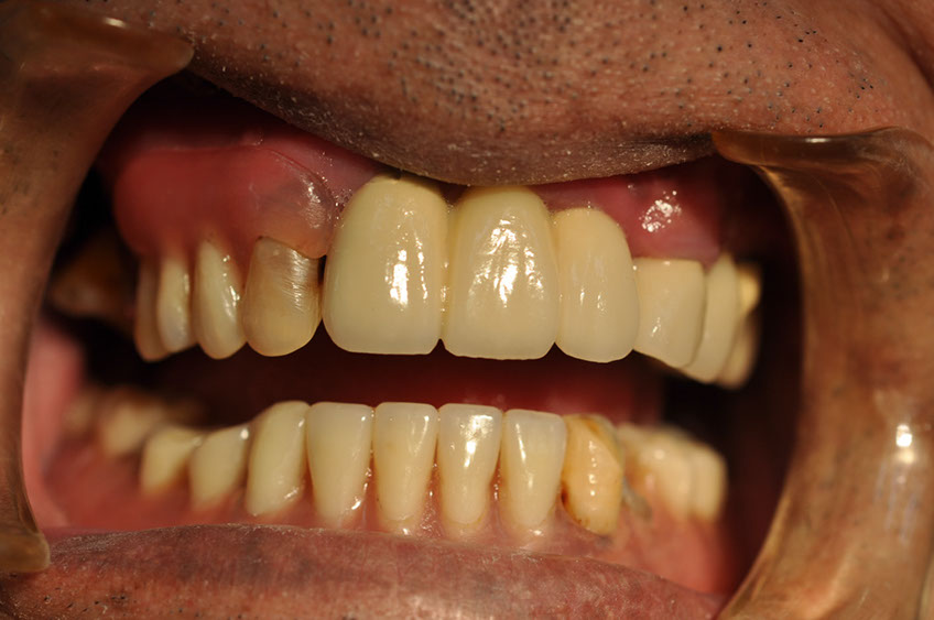 %_tempFileNameImplant%2080c8%