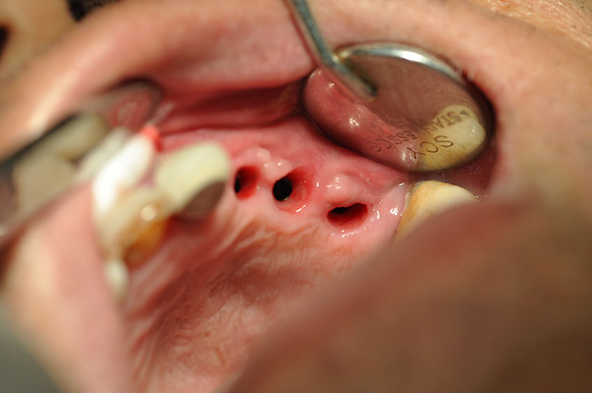 %_tempFileNameImplant%2083c1%