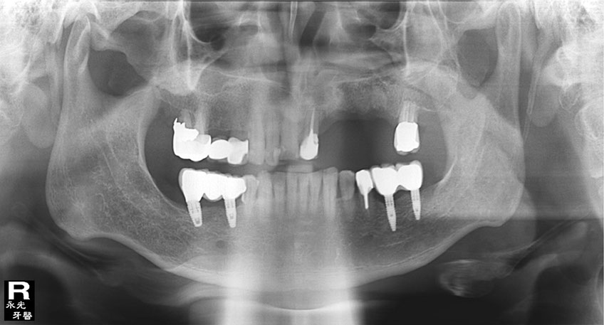%_tempFileNameImplant%2083d1%
