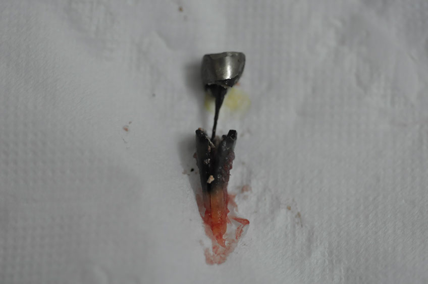 %_tempFileNameImplant%2085a3%