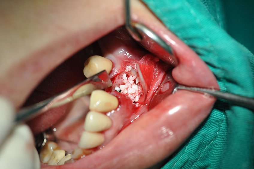 %_tempFileNameImplant%2085b4%