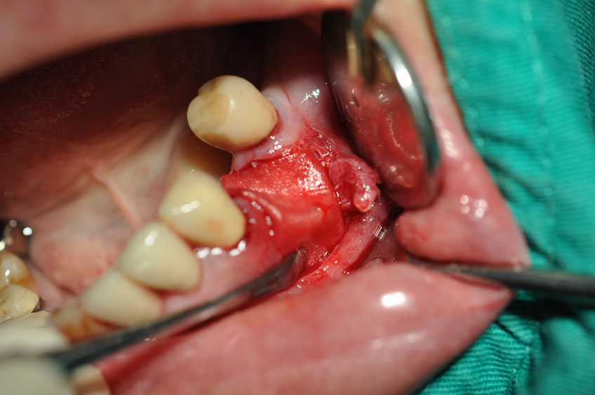 %_tempFileNameImplant%2085b5%
