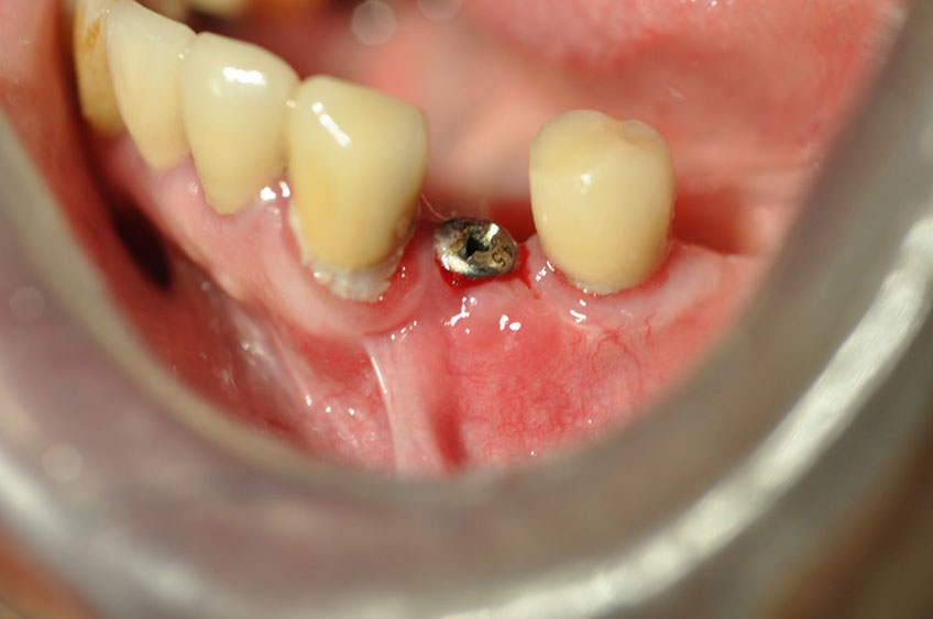 %_tempFileNameImplant%2085c1%