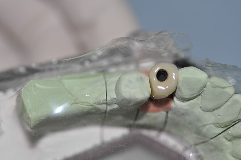 %_tempFileNameImplant%2085c3%