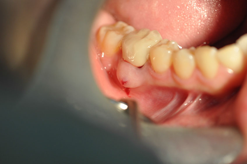 %_tempFileNameImplant%2086a1%