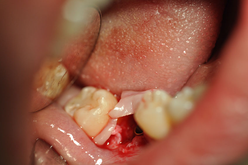 %_tempFileNameImplant%2086b1%