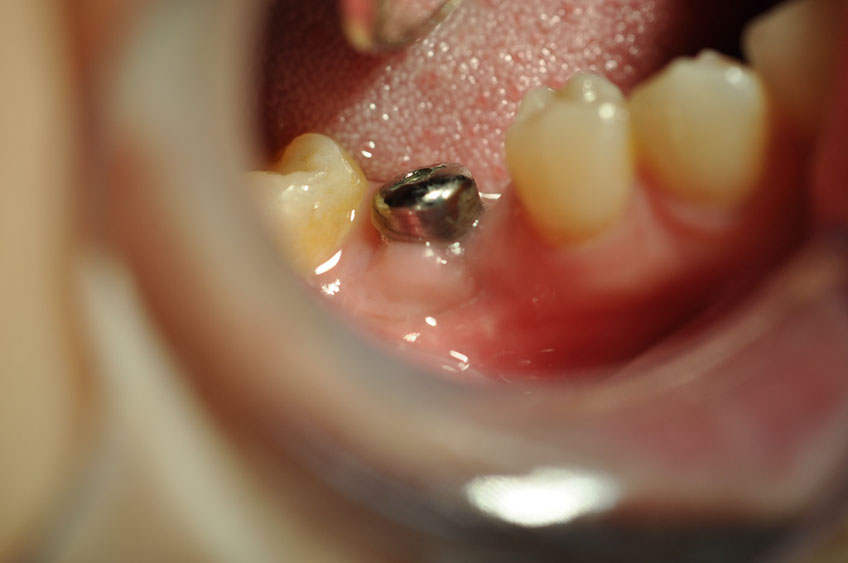 %_tempFileNameImplant%2086c1%