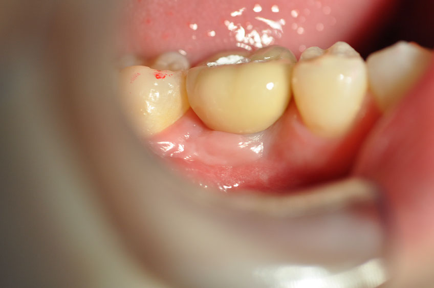 %_tempFileNameImplant%2086c4%
