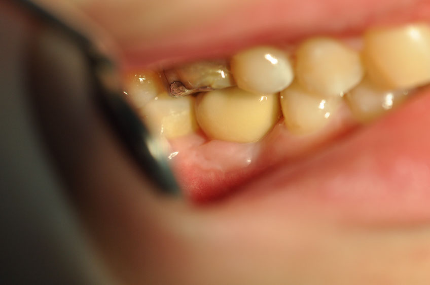 %_tempFileNameImplant%2086c5%