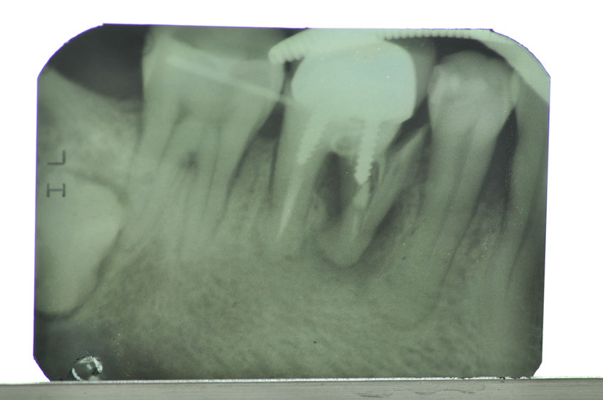 %_tempFileNameImplant%2088a1%
