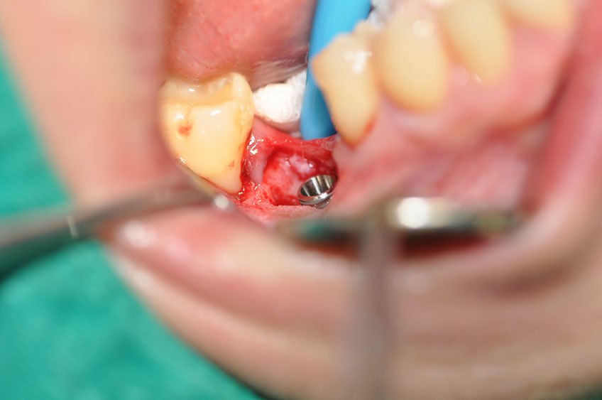 %_tempFileNameImplant%2088a3%