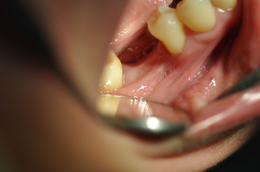 %_tempFileNameImplant%2088a5%