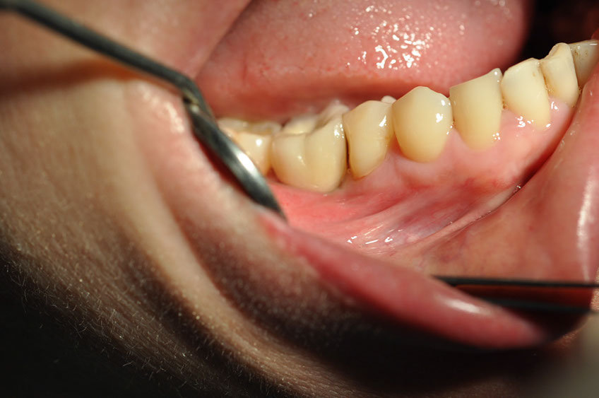 %_tempFileNameImplant%2088c1%