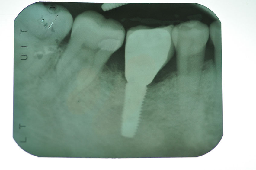 %_tempFileNameImplant%2088d1%