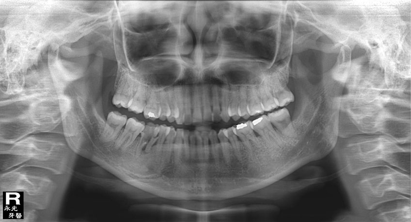 %_tempFileNameImplant%2088d2%