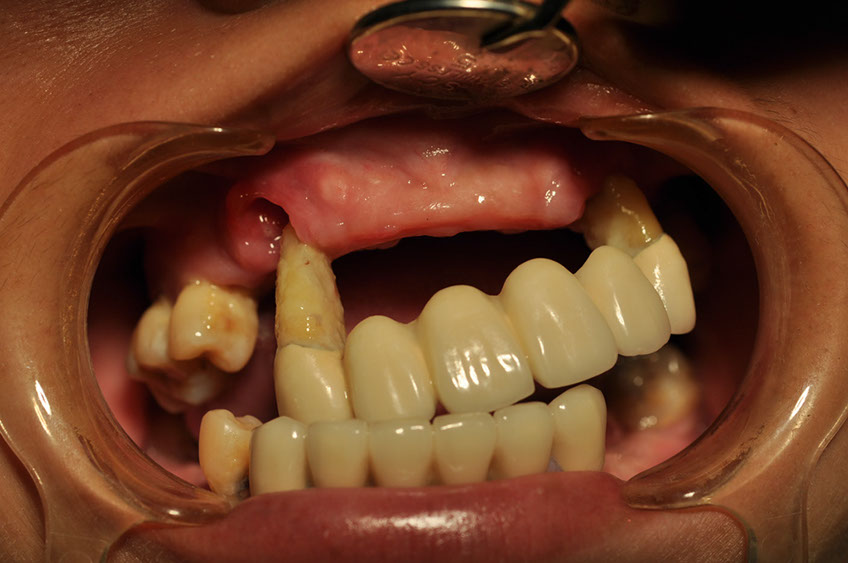 %_tempFileNameImplant%2089a1%