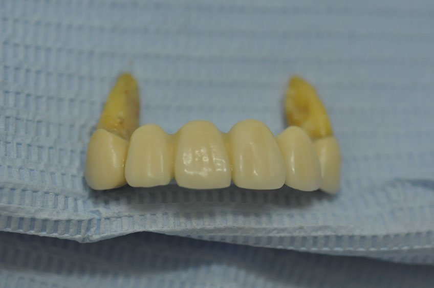 %_tempFileNameImplant%2089a3%