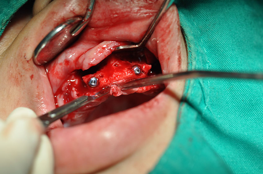 %_tempFileNameImplant%2089b3%