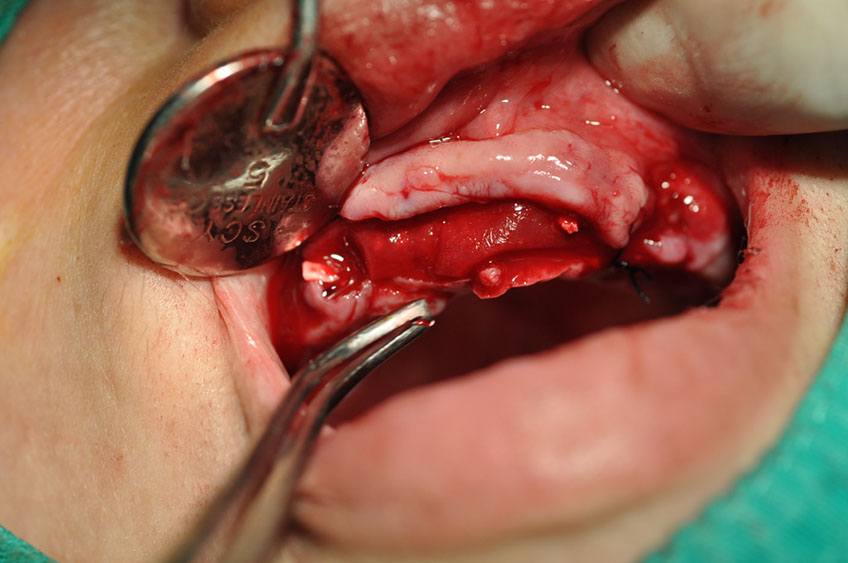 %_tempFileNameImplant%2089b5%