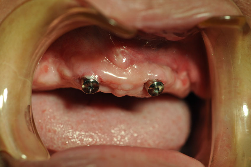 %_tempFileNameImplant%2089c2%