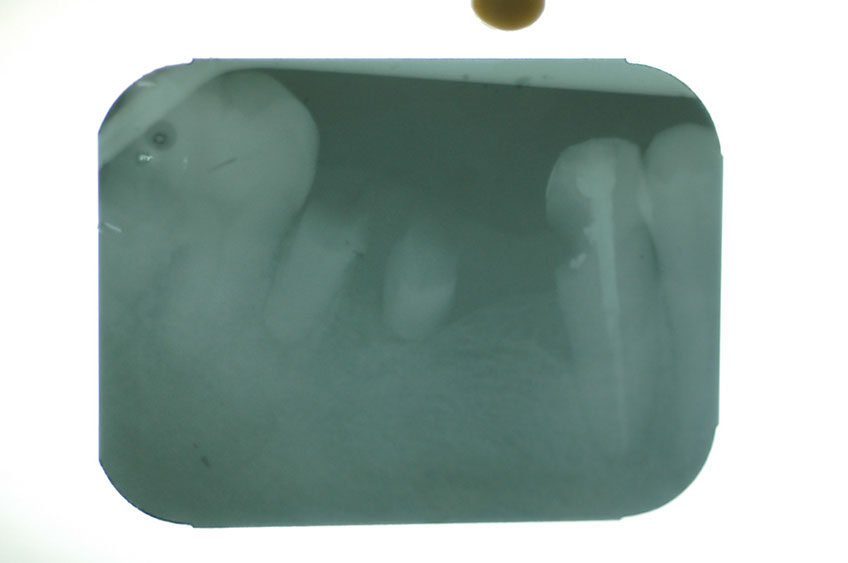 %_tempFileNameImplant%208g%