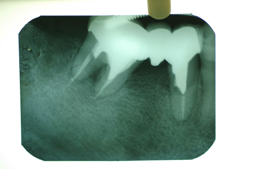 %_tempFileNameImplant%208j3%
