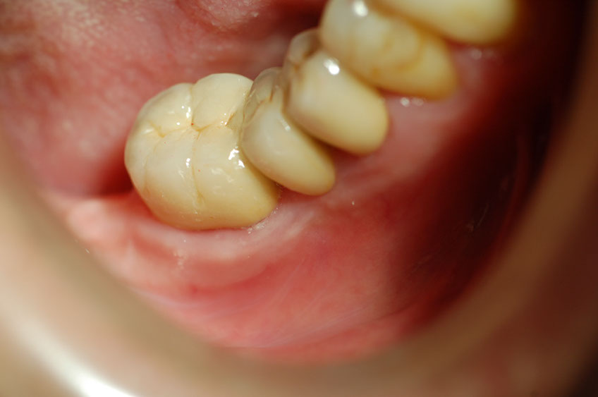 %_tempFileNameImplant%208o3%