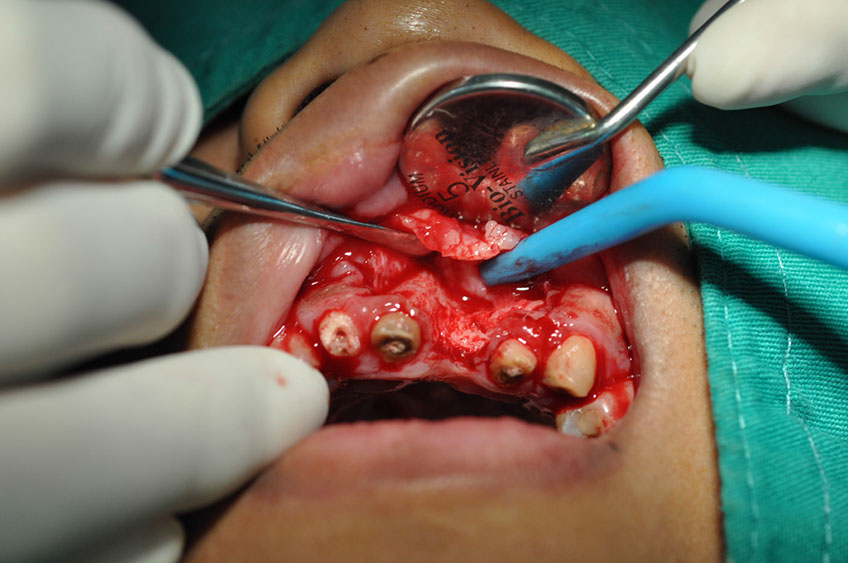 %_tempFileNameImplant%2090a4%