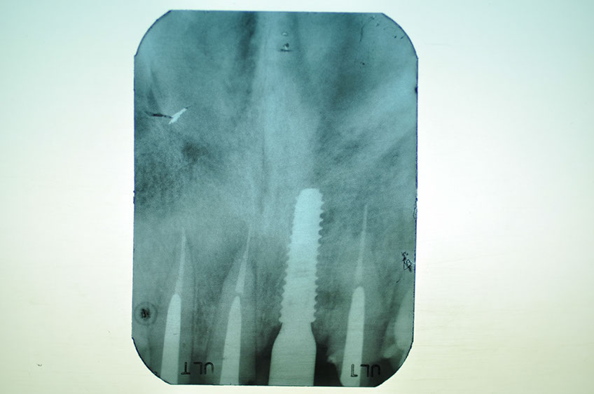 %_tempFileNameImplant%2090c5%