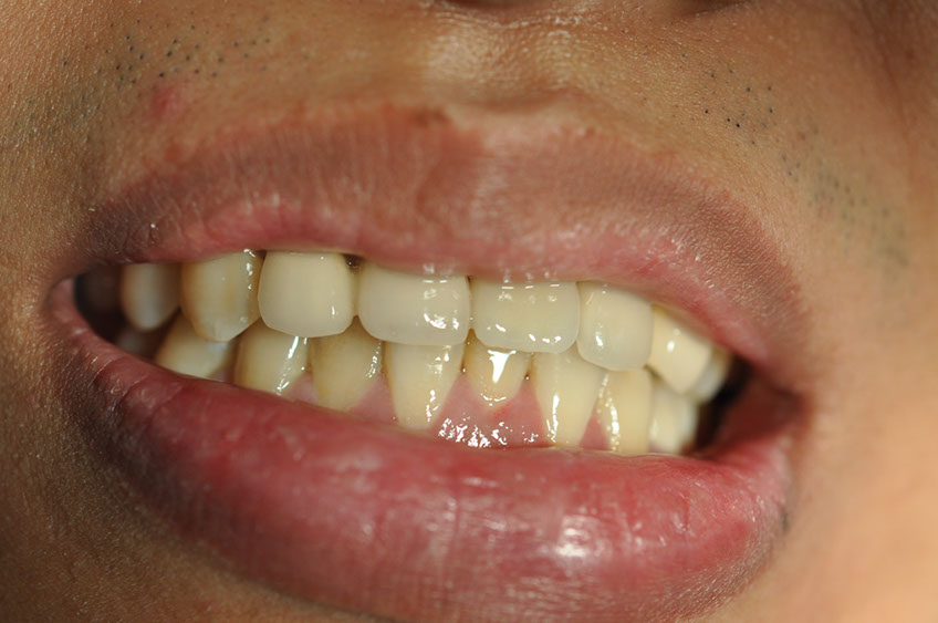 %_tempFileNameImplant%2090d3%