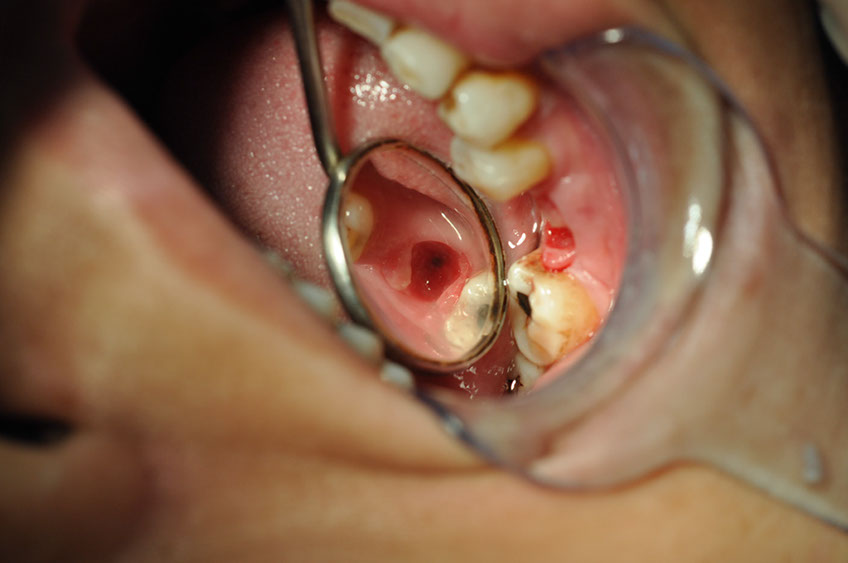 %_tempFileNameImplant%2091a4%