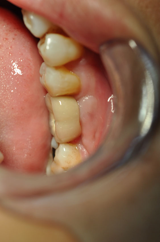 %_tempFileNameImplant%2091b1%