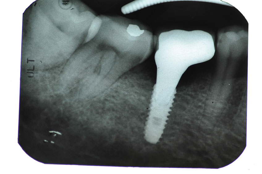 %_tempFileNameImplant%2091c3%