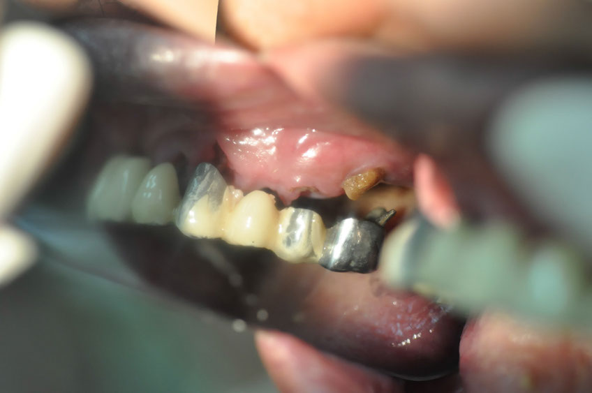 %_tempFileNameImplant%2092Ua2%