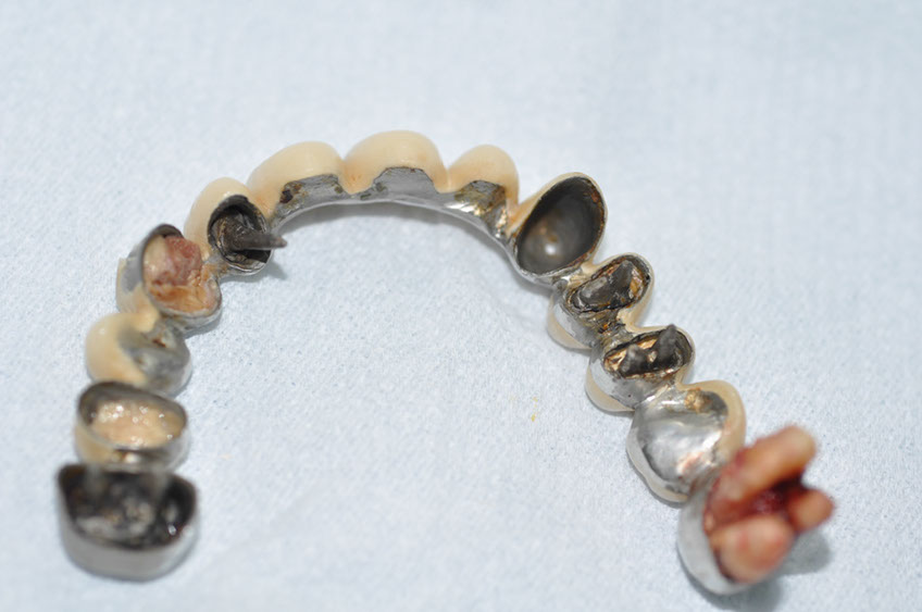 %_tempFileNameImplant%2092Ua4%