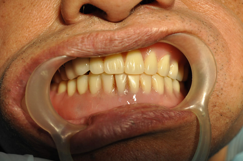 %_tempFileNameImplant%2092Uc2%