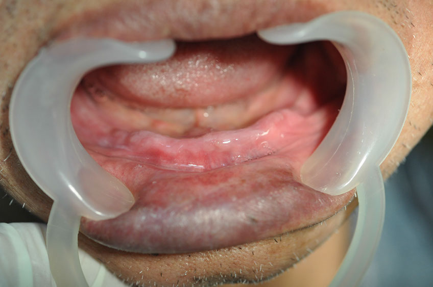 %_tempFileNameImplant%2092a1%