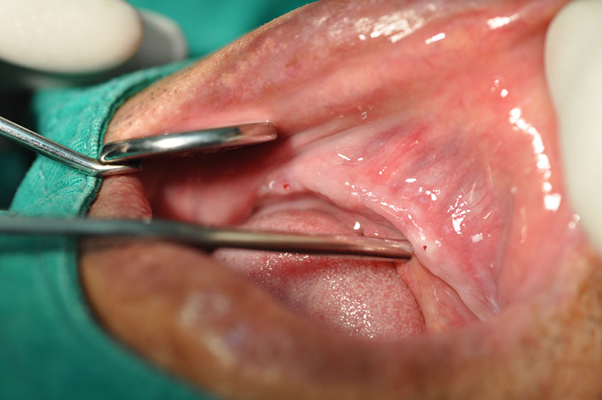 %_tempFileNameImplant%2092a4%