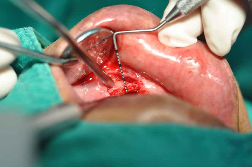 %_tempFileNameImplant%2092a5%