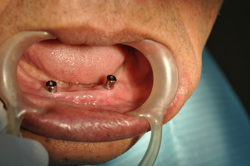 %_tempFileNameImplant%2092b3%
