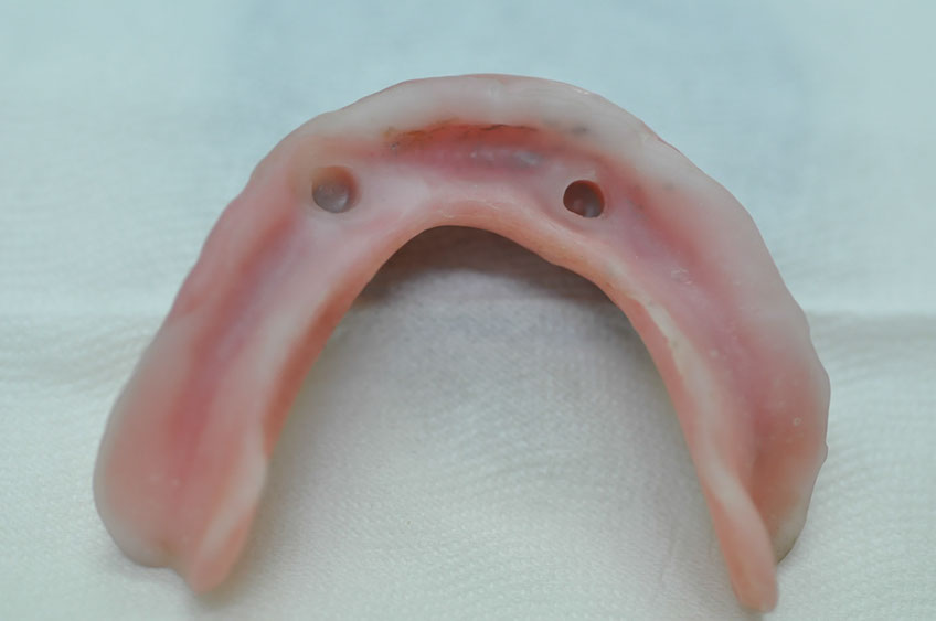 %_tempFileNameImplant%2092b5%
