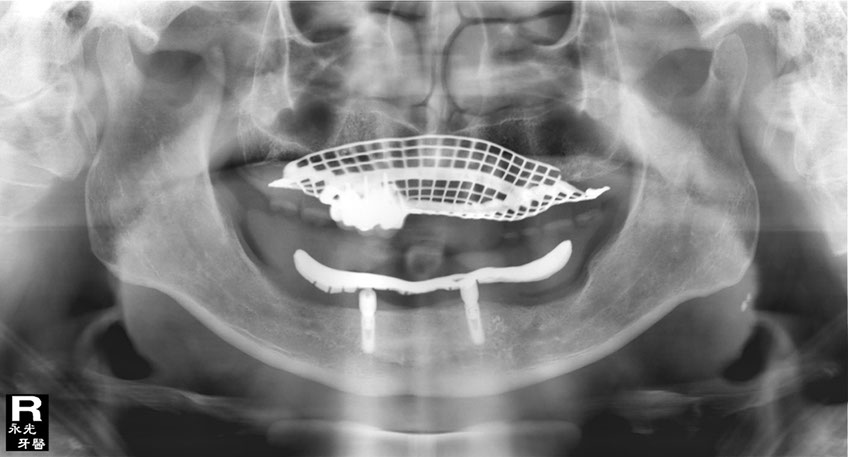 %_tempFileNameImplant%2092c1%