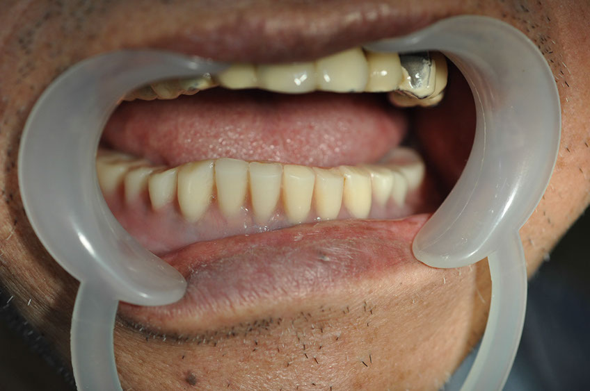 %_tempFileNameImplant%2092c2%
