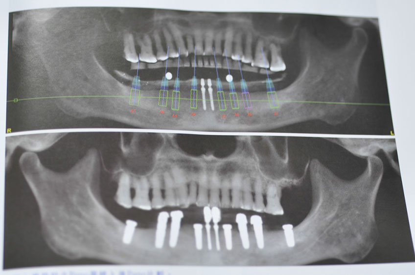 %_tempFileNameImplant%2092c3(3)%
