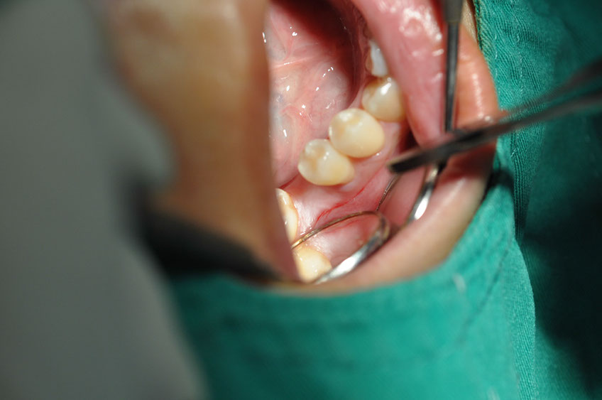 %_tempFileNameImplant%2093a1%