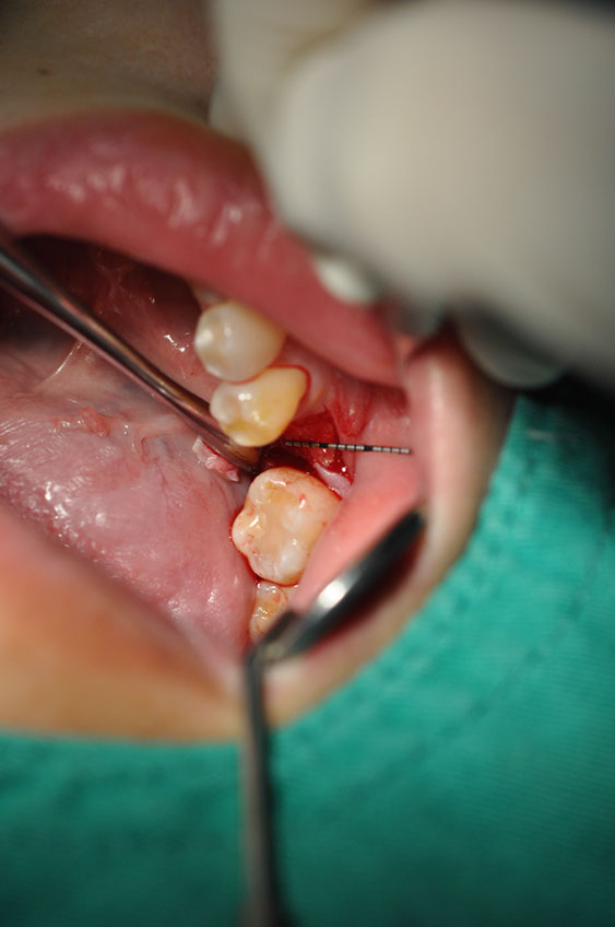 %_tempFileNameImplant%2093b1%